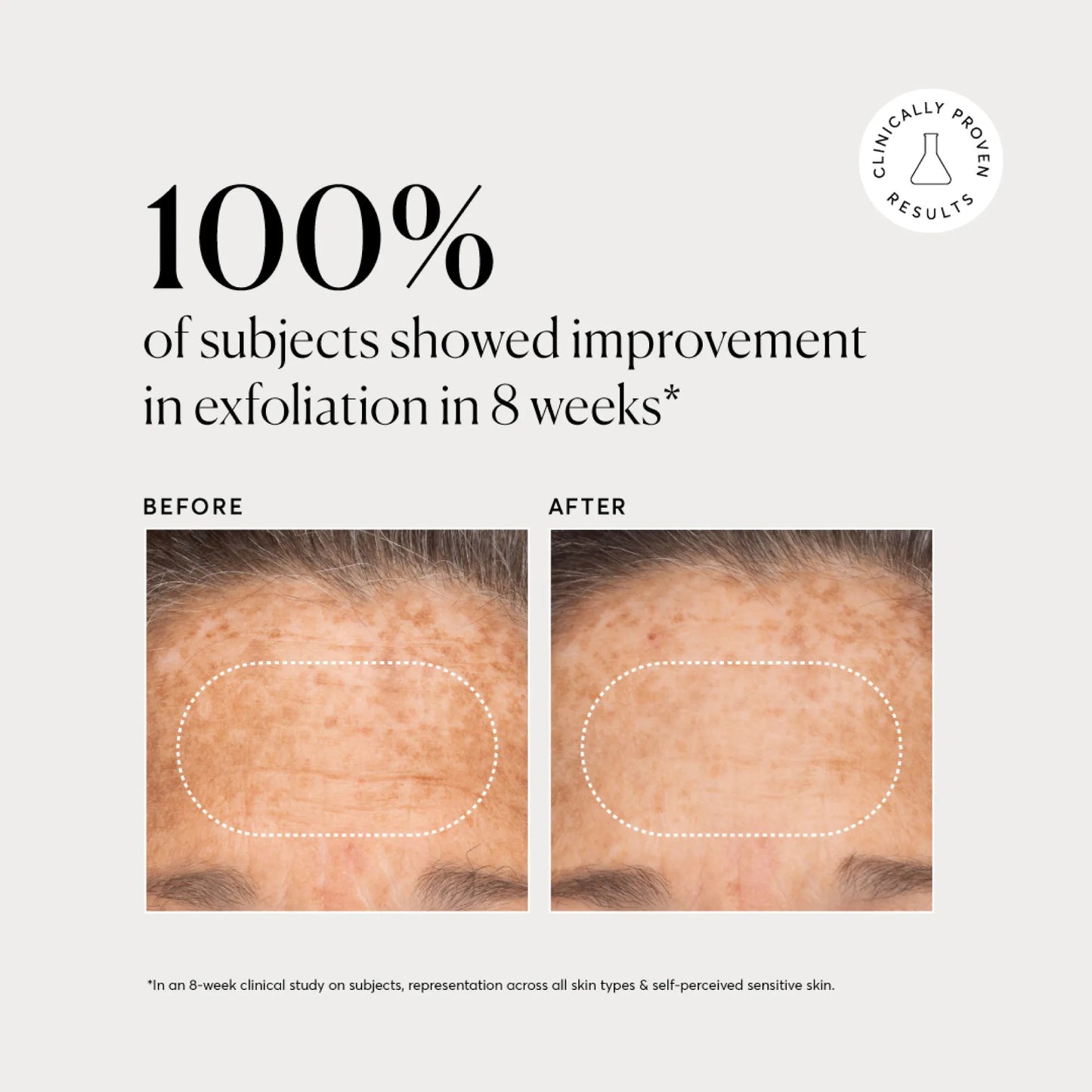 bha-liquid-exfoliant-2-m4 NATR-10027-Alt-Images-BHA-Liquid-Exfoliant-2_-03.webp